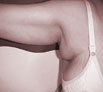 Arms Reshaping in Chandigarh