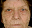 facial reconstruction surgery in Punjab
