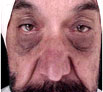 facial reconstruction surgery in Punjab
