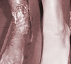Leg trauma treatment in Chandigarh