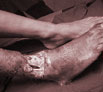 Leg trauma treatment in Punjab