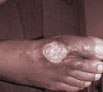 Leg trauma treatment in Chandigarh
