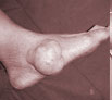 Leg trauma treatment in Punjab